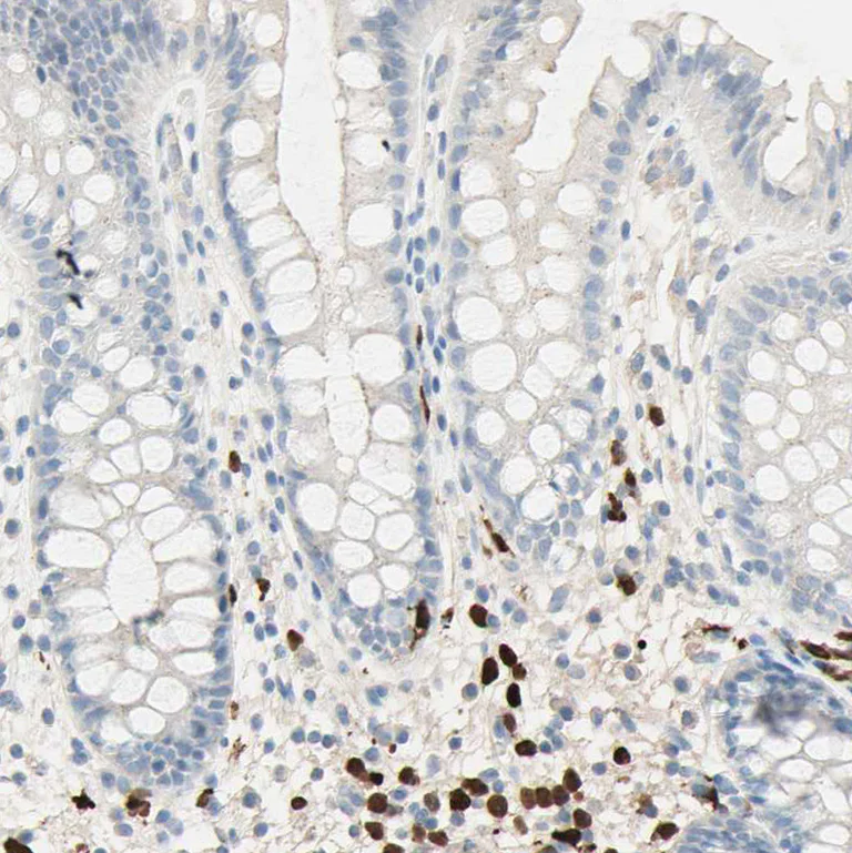 Immunohistochemistry (Formalin/PFA-fixed paraffin-embedded sections) - Anti-IKB zeta antibody (AB246894)