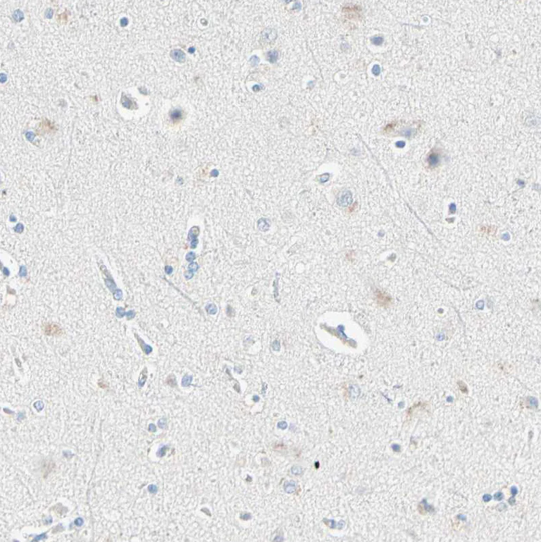 Immunohistochemistry (Formalin/PFA-fixed paraffin-embedded sections) - Anti-IKB zeta antibody (AB246894)