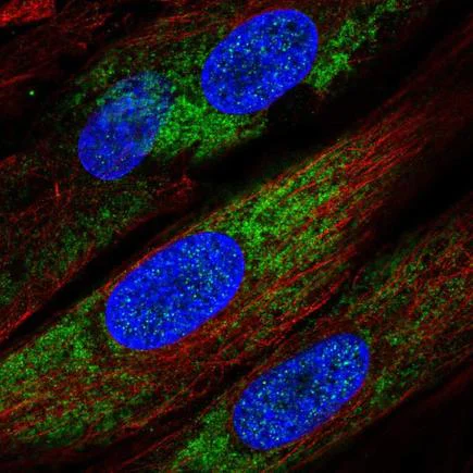Immunocytochemistry/ Immunofluorescence - Anti-IKIP antibody (AB221171)