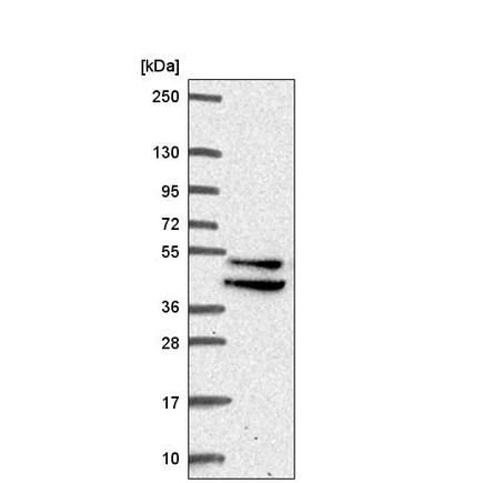 Western blot - Anti-IKIP antibody (AB221171)