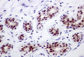 Immunohistochemistry (Formalin/PFA-fixed paraffin-embedded sections) - Anti-IKK alpha antibody [EPR464] - BSA and Azide free (AB171362)