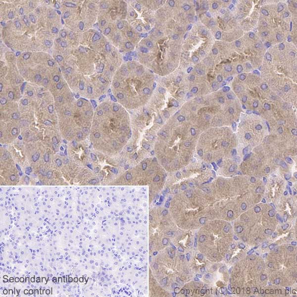 Immunohistochemistry (Formalin/PFA-fixed paraffin-embedded sections) - Anti-IKK alpha antibody [Y463] (ab32041), expandable thumbnail