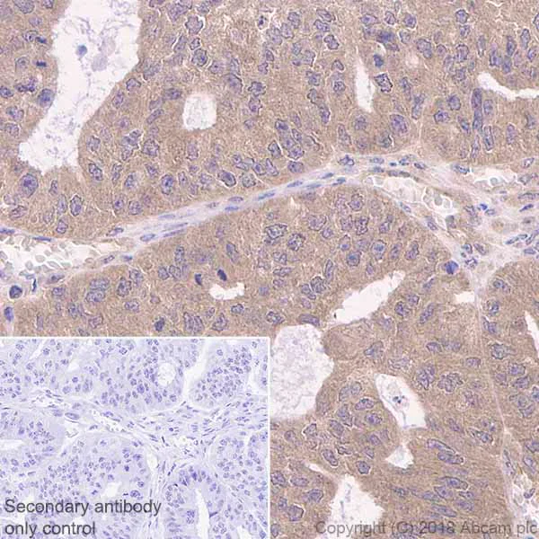 Anti-IKK alpha antibody [Y463] (ab32041) | Abcam