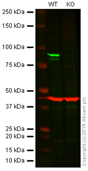 Western blot - Anti-IKK alpha antibody [Y463] (AB32041), expandable thumbnail