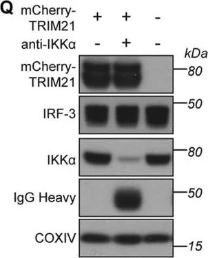 Western blot - Anti-IKK alpha antibody [Y463] - BSA and Azide free (AB169743)