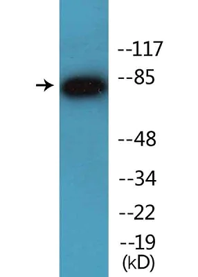 Western blot - Anti-IKK alpha (phospho S176) antibody (AB138426)
