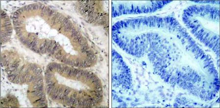 Immunohistochemistry (Formalin/PFA-fixed paraffin-embedded sections) - Anti-IKK alpha (phospho T23) antibody (AB38515)