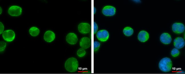 Immunocytochemistry/ Immunofluorescence - Anti-IKK beta antibody (AB183966)