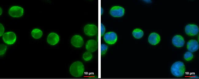 Immunocytochemistry/ Immunofluorescence - Anti-IKK beta antibody (AB183966)