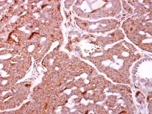 Immunohistochemistry - Anti-IKK beta antibody (AB183966)