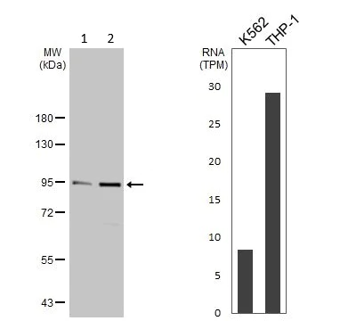 Western blot - Anti-IKK beta antibody (AB183966)