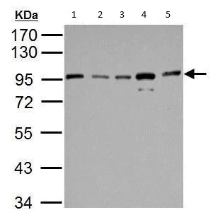Western blot - Anti-IKK beta antibody (AB183966)