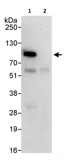 Immunoprecipitation - Anti-IKK beta antibody (AB264239)