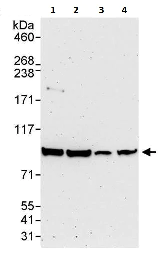 Western blot - Anti-IKK beta antibody (AB264239)