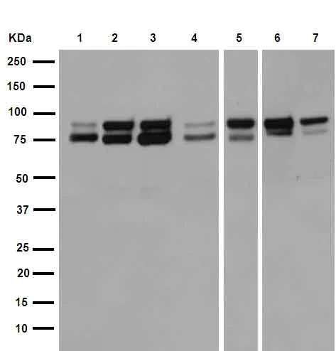 Western blot - Anti- IKK beta antibody [EPR16628] (AB178870)