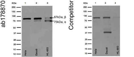 Western blot - Anti- IKK beta antibody [EPR16628] (AB178870)