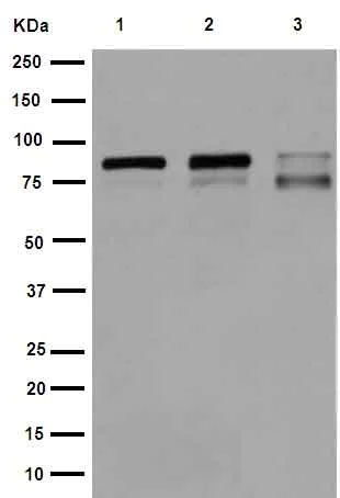 Western blot - Anti- IKK beta antibody [EPR16628] (AB178870)