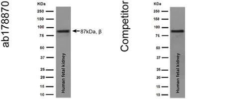 Western blot - Anti- IKK beta antibody [EPR16628] (AB178870)