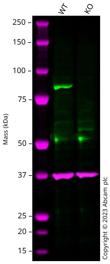 Western blot - Anti- IKK beta antibody [EPR16628] (AB178870)