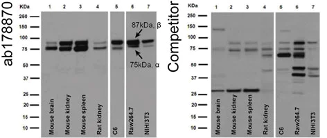 Western blot - Anti- IKK beta antibody [EPR16628] (AB178870)