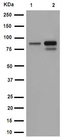 Western blot - Anti- IKK beta antibody [EPR16628] (AB178870)