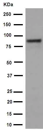 Western blot - Anti- IKK beta antibody [EPR16628] (AB178870)