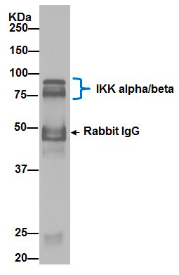 Immunoprecipitation - Anti- IKK beta antibody [EPR16628] - BSA and Azide free (AB240210), expandable thumbnail