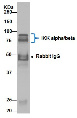 Immunoprecipitation - Anti- IKK beta antibody [EPR16628] - BSA and Azide free (AB240210)
