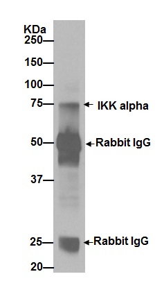 Immunoprecipitation - Anti- IKK beta antibody [EPR16628] - BSA and Azide free (AB240210), expandable thumbnail