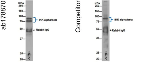 Immunoprecipitation - Anti- IKK beta antibody [EPR16628] - BSA and Azide free (AB240210)