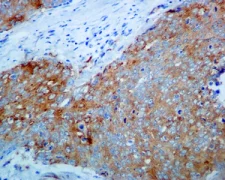 Immunohistochemistry (Formalin/PFA-fixed paraffin-embedded sections) - Anti-IKK beta antibody [EPR6043] (AB124957)