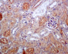 Immunohistochemistry (Formalin/PFA-fixed paraffin-embedded sections) - Anti-IKK beta antibody [EPR6043] (AB124957)