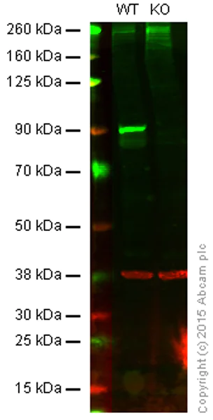Western blot - Anti-IKK beta antibody [EPR6043] (AB124957)