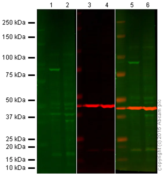 Western blot - Anti-IKK beta antibody [Y466] (AB32135)