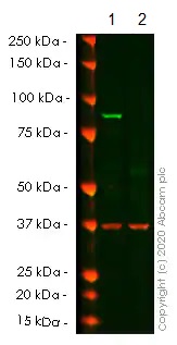 Western blot - Anti-IKK beta antibody [Y466] (AB32135)