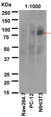 Western blot - Anti-IKK beta antibody [Y466] (AB32135)