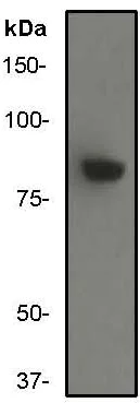 Western blot - Anti-IKK beta antibody [Y466] (AB32135)