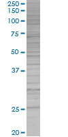 IKK beta overexpression 293T lysate (whole cell)