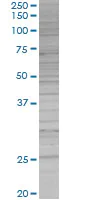 SDS-PAGE - IKK beta overexpression 293T lysate (whole cell) (AB94065)