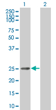 Western blot - IKK beta overexpression 293T lysate (whole cell) (AB94065)