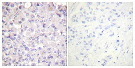 Immunohistochemistry (Formalin/PFA-fixed paraffin-embedded sections) - Anti-IKK beta (phospho Y188) antibody (AB194519)