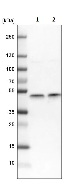 Western blot - Anti-IKK gamma/NEMO antibody (AB244244)