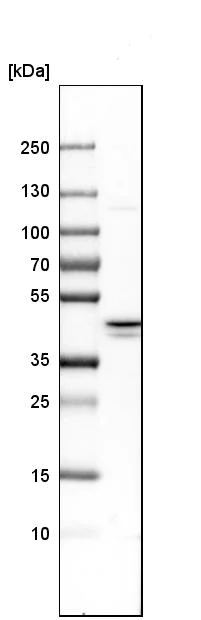 Western blot - Anti-IKK gamma/NEMO antibody (AB244244)