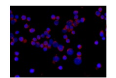Immunocytochemistry/ Immunofluorescence - Anti-IKK gamma/NEMO antibody [EPR14660] (AB188569), expandable thumbnail