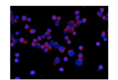 Immunocytochemistry/ Immunofluorescence - Anti-IKK gamma/NEMO antibody [EPR14660] (AB188569)