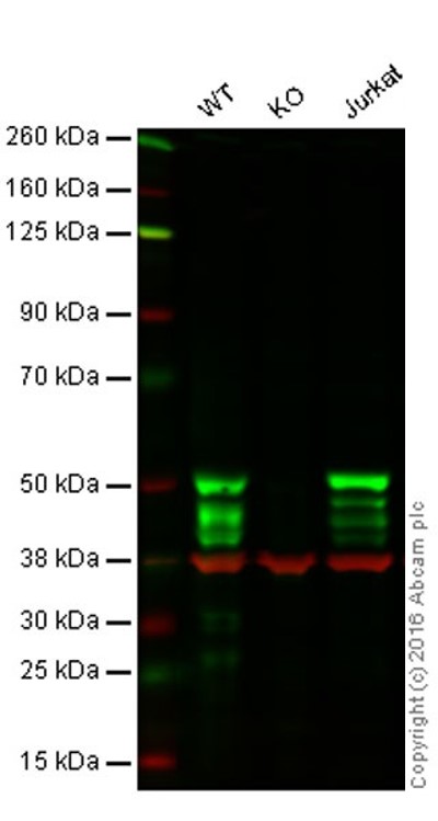 Western blot - Anti-IKK gamma/NEMO antibody [EPR14660] (AB188569), expandable thumbnail