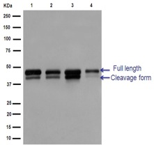 Western blot - Anti-IKK gamma/NEMO antibody [EPR14660] (AB188569), expandable thumbnail