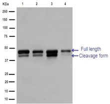 Western blot - Anti-IKK gamma/NEMO antibody [EPR14660] (AB188569)