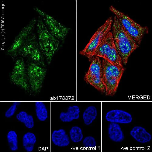 Immunocytochemistry/ Immunofluorescence - Anti-IKK gamma/NEMO antibody [EPR16629] (AB178872)