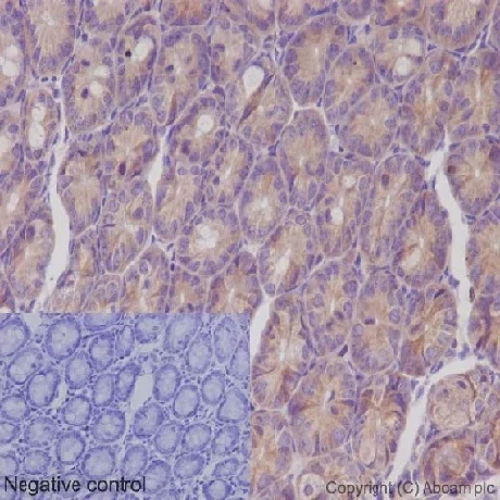 Immunohistochemistry (Formalin/PFA-fixed paraffin-embedded sections) - Anti-IKK gamma/NEMO antibody [EPR16629] (AB178872)